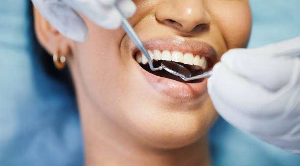 Best Emergency Denture Repair in Columbia Heights, MN