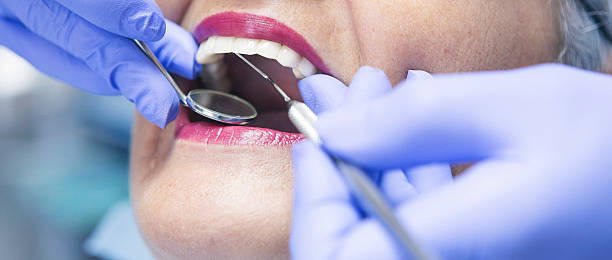 Best Emergency Treatment for Dental Infections or Abscesses in Columbia Heights, MN